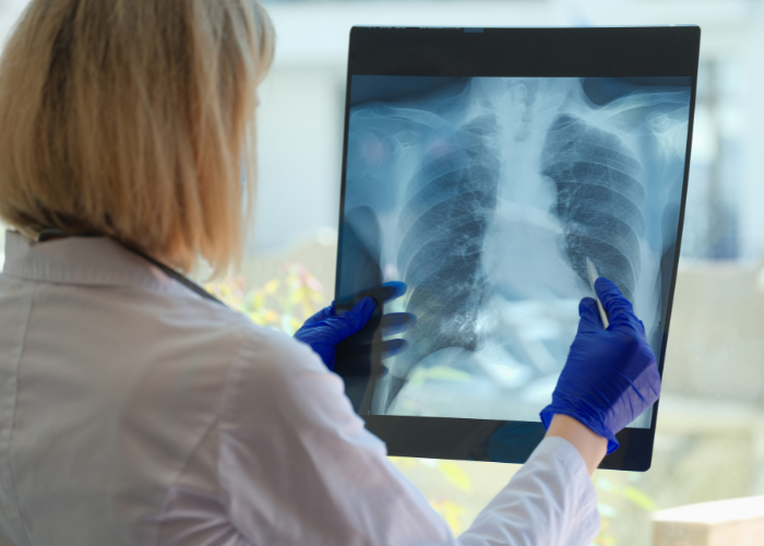 12-doctor-reviewing-chest-xray